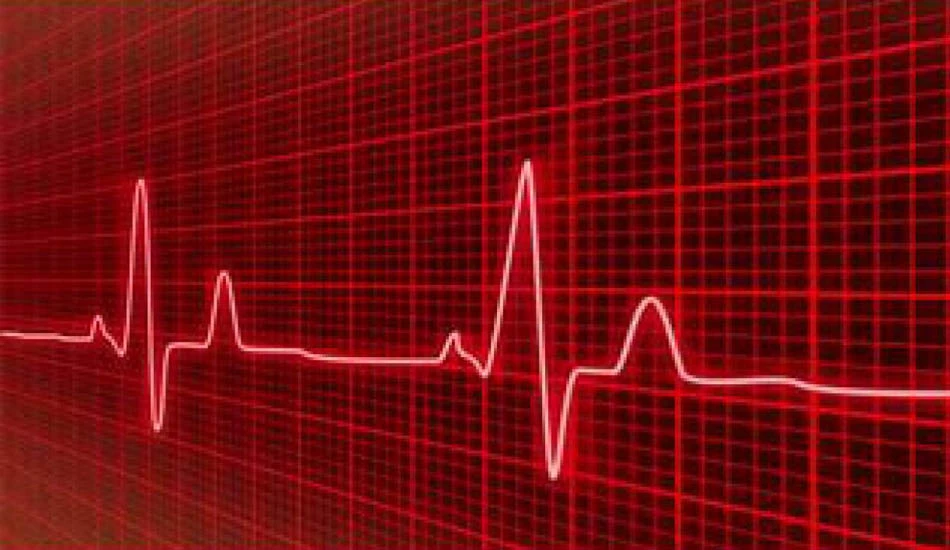 ecg چیست و چه کاربردی دارد
