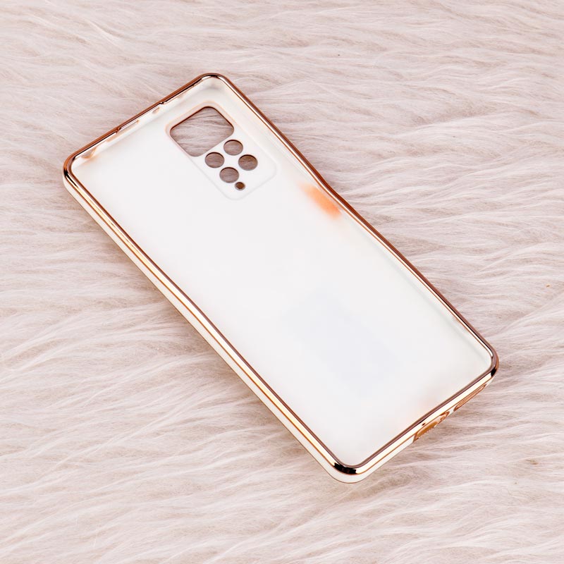 قاب براق My Case استند طرح سگ محافظ لنزدار Xiaomi Redmi Note 11 Pro 5G