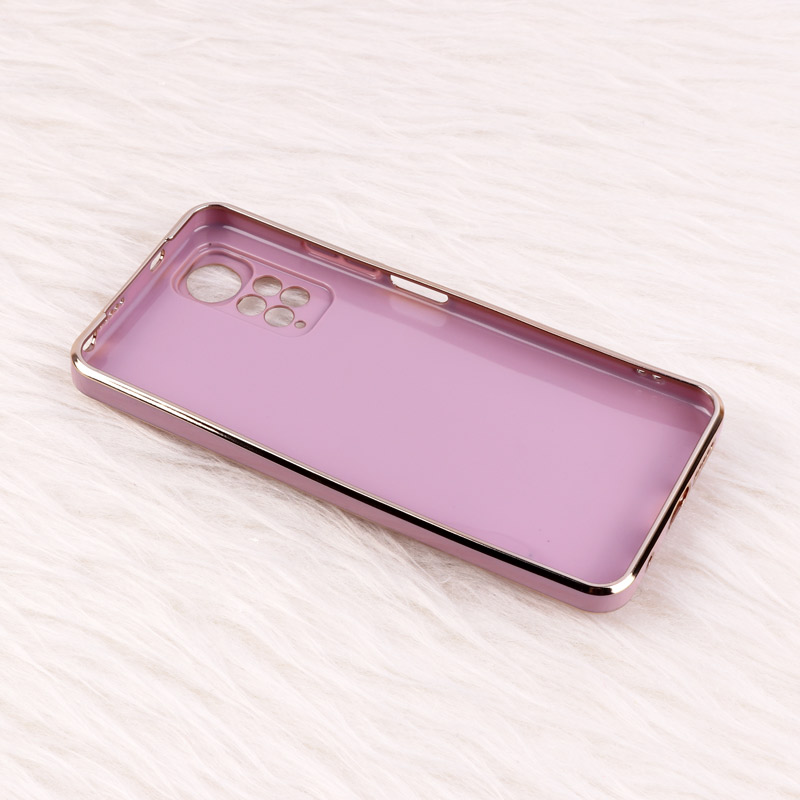 قاب عروسکی Rabbit استندشو محافظ لنزدار Xiaomi Redmi Note 11 / 11s سری 2