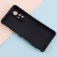 قاب هاشور دار طرح دار Xiaomi 12 Lite