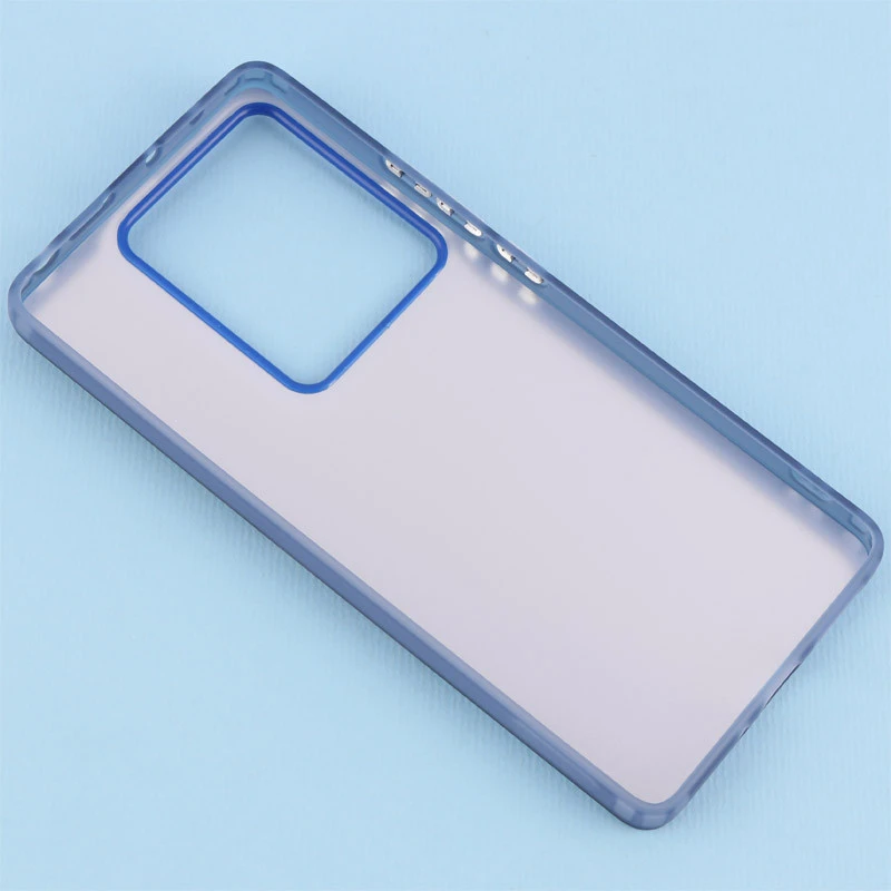 قاب PC So Cool شیائومی Redmi Note 13 Pro 4G