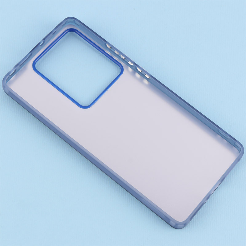 قاب PC So Cool شیائومی Redmi Note 13 Pro 4G