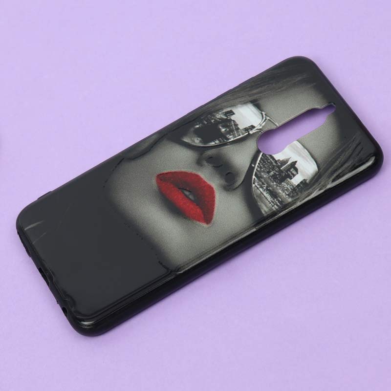 قاب فانتزی برجسته دخترانه شیائومی Mate 10 Lite سری 2