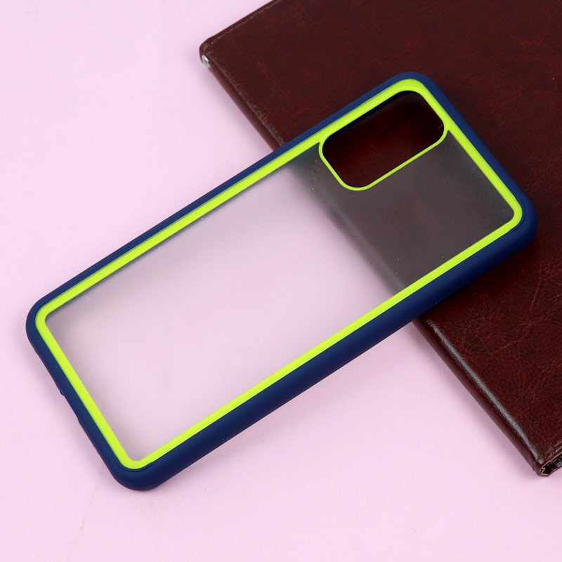 قاب PC شفاف Xiaomi Poco M3