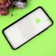 قاب فانتزی برجسته دخترانه هواوی P10 Lite سری 7