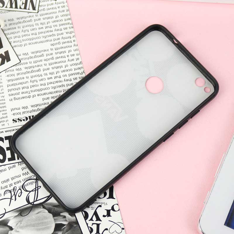 قاب فانتزی برجسته کد14 هواوی Honor 8 Lite سری E