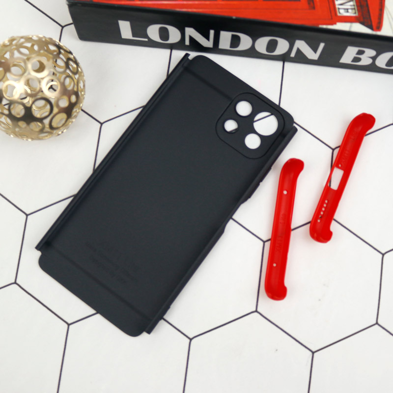 قاب اورجینال 360 درجه GKK Xiaomi Mi 11 Lite