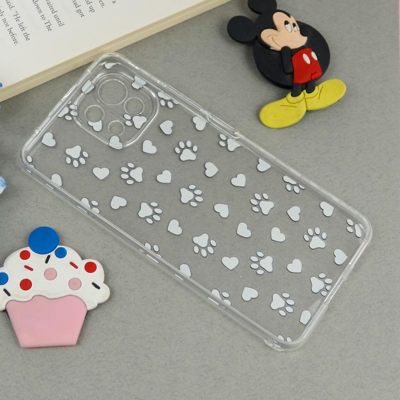 قاب ژله ای شیائومی Mi 11 Lite طرح ردپا محافظ لنزدار