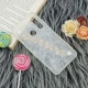 قاب ماربل هولدر دستی مرواریدی Xiaomi Redmi Note 8