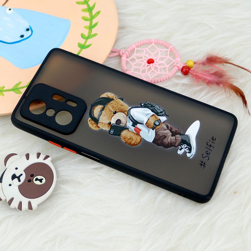 قاب PC مات محافظ لنزدار طرحدار Xiaomi 11T / 11T Pro