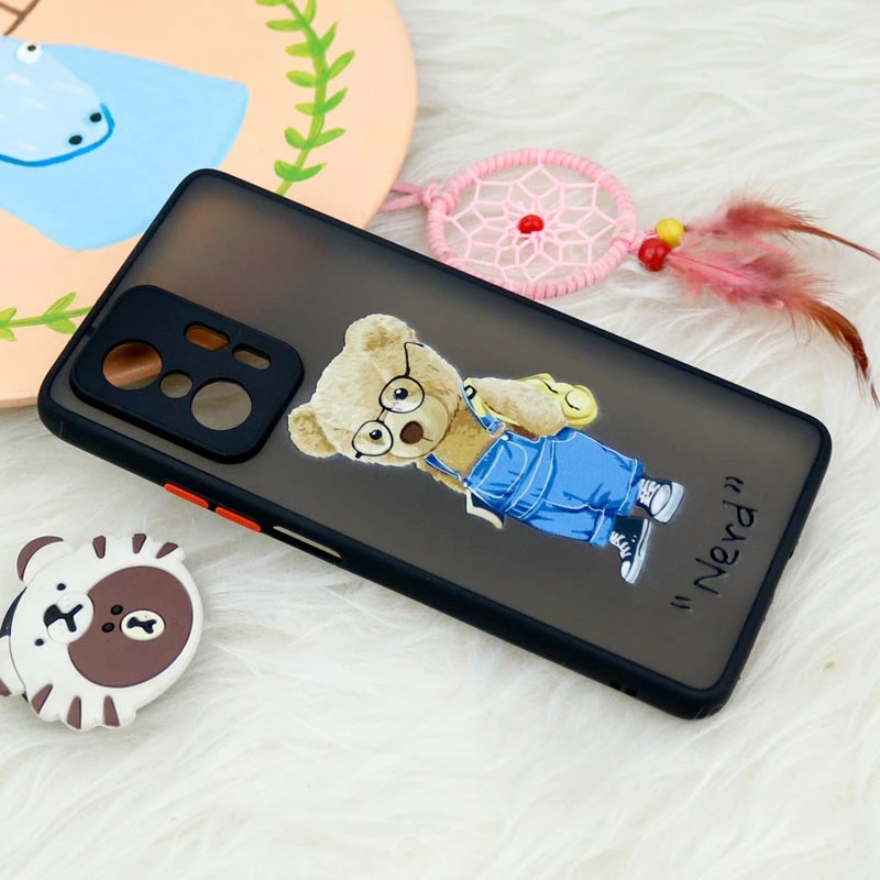 قاب PC مات محافظ لنزدار طرحدار Xiaomi 11T / 11T Pro