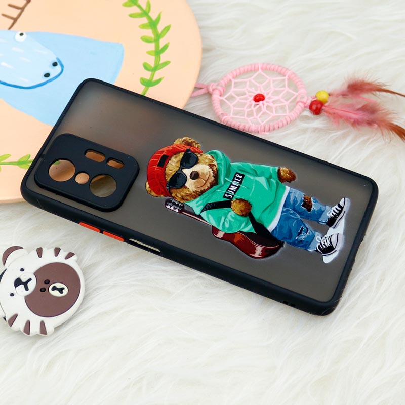 قاب PC مات محافظ لنزدار طرحدار Xiaomi 11T / 11T Pro