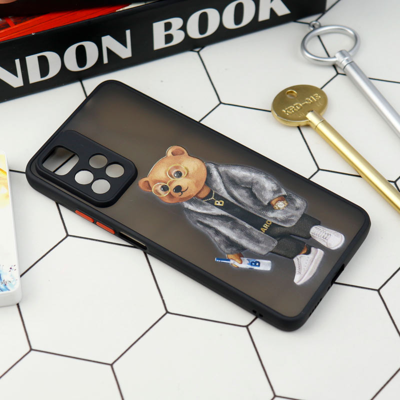 قاب PC مات محافظ لنزدار طرحدار Xiaomi Redmi Note 11 Pro Plus