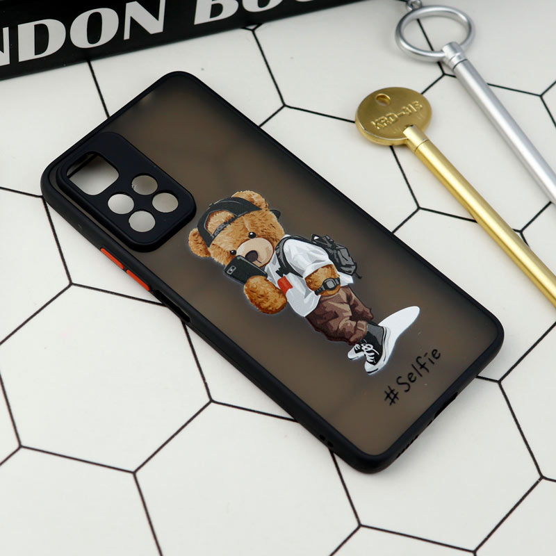 قاب PC مات محافظ لنزدار طرحدار Xiaomi Redmi Note 11 Pro Plus