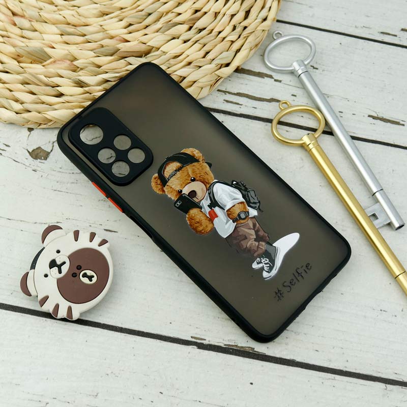 قاب PC مات محافظ لنزدار طرحدار Xiaomi Redmi Note 11 5G