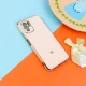 قاب براق My Case محافظ لنزدار Xiaomi Redmi Note 10