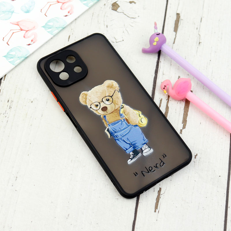 قاب PC مات محافظ لنزدار طرحدار Xiaomi Mi 11 Lite