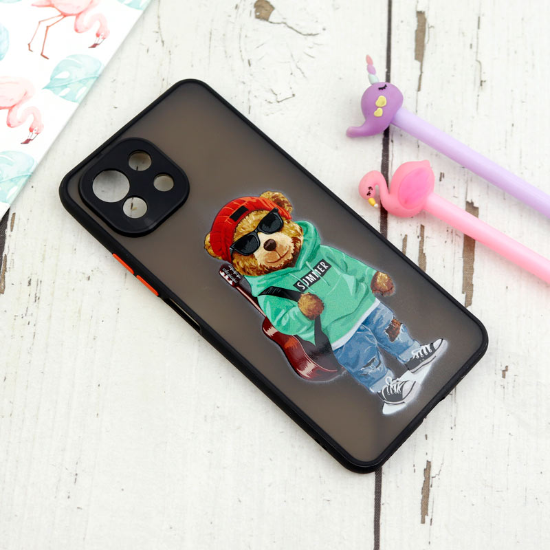 قاب PC مات محافظ لنزدار طرحدار Xiaomi Mi 11 Lite