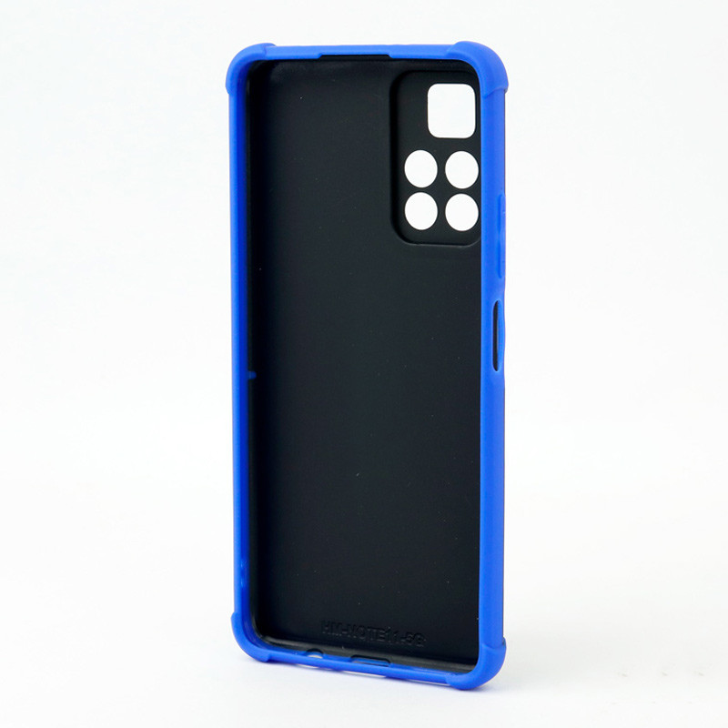 قاب PC کبریتی Xiaomi Redmi Note 11 5G (China)