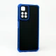 قاب PC کبریتی Xiaomi Redmi Note 11 Pro (China)