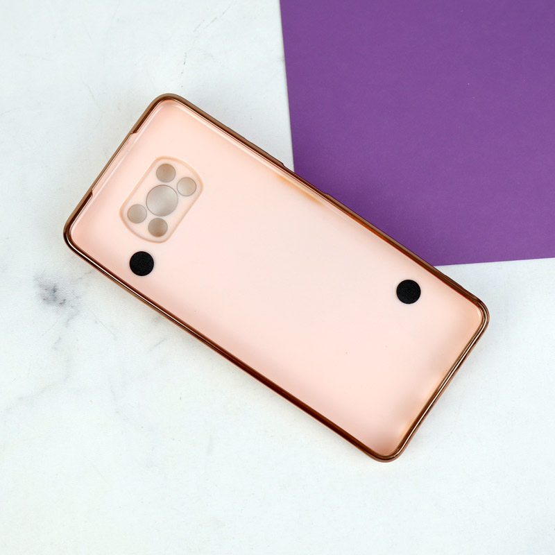 قاب My Case محافظ لنزدار + بند آویز Xiaomi Poco X3