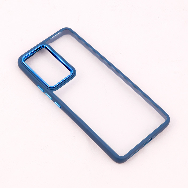 قاب PC شیائومی Xiaomi 12 Pro متال ایرون