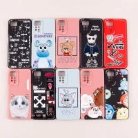 قاب شیائومی Redmi Note 11 Pro طرح دوخت محافظ لنزدار